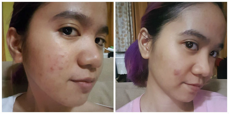 Mosbeau Collagen Plus 12000 Review - Style Vanity