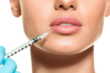 lip fillers surgery injection