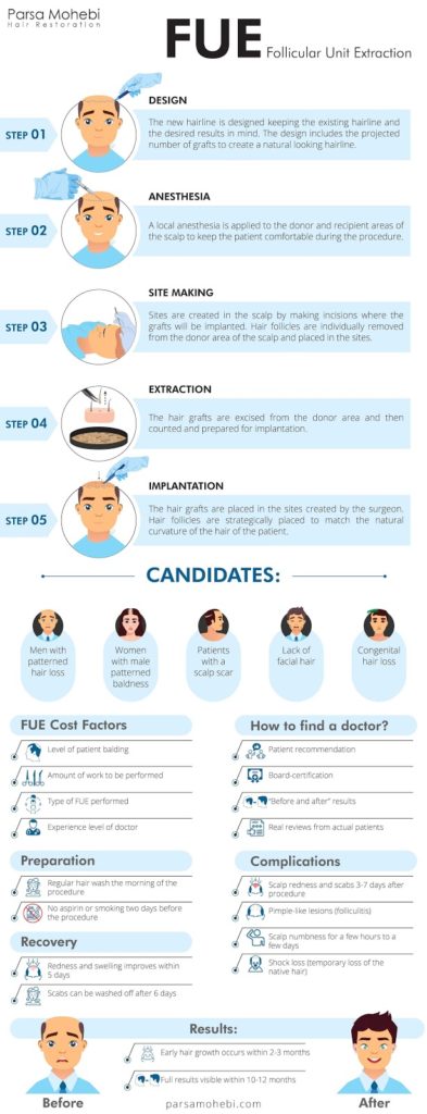 Process Of A FUE Hair Transplant - Style Vanity