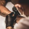 Skin Treatment and Tattoo Removal