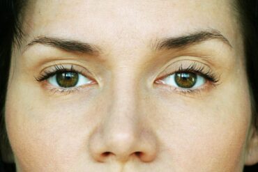 Seven Things You Should Know Before Undergoing Ptosis Surgery in Singapore