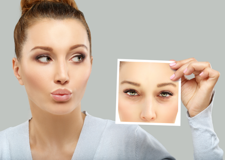 Sunken Face And Hollow Temples What Are The Treatment Options Style Vanity 5348