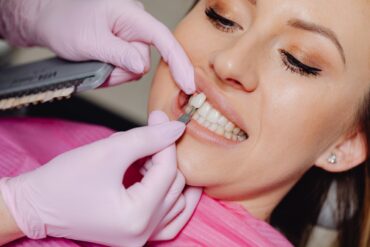 cosmetic dentist New Orleans - porcelain veneers