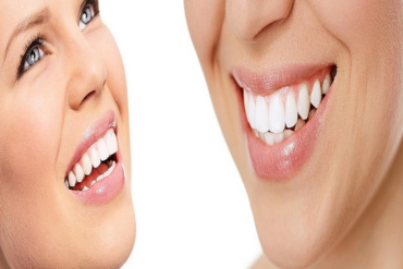 teeth whitening mornington